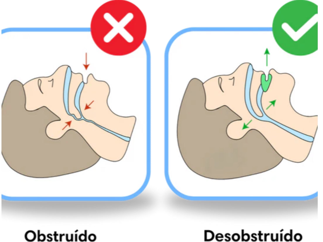 SILENT SLEEP® ANTIRRONQUIDO + EBOOK GRATUITO