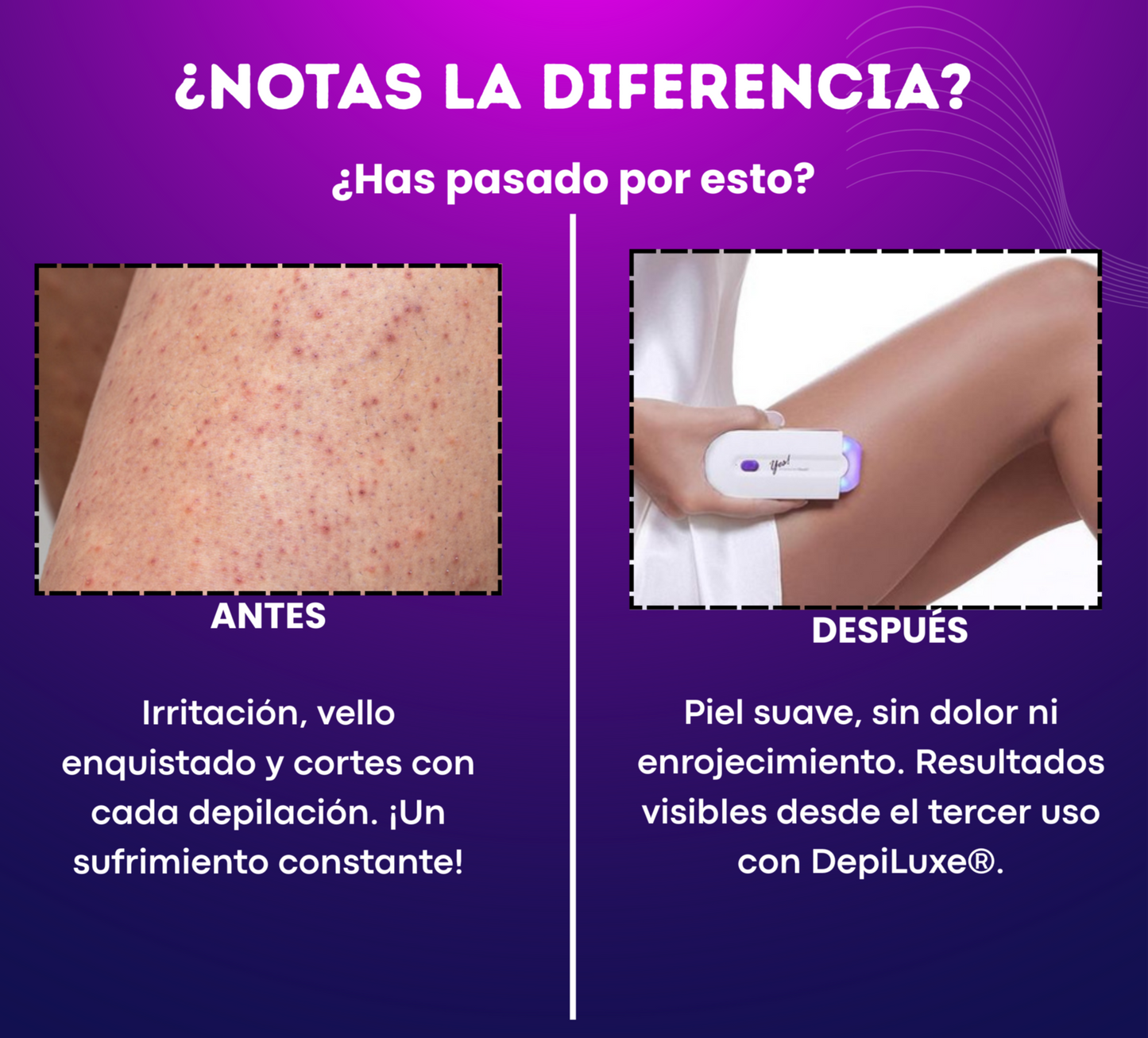 Depiladora DepiLuxe® Quita el vello de raíz y cuida tu piel + Envío gratis 🎁